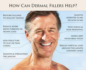 Trial Offer Hyaluronic Acid Injection Dermal Fillers 1ml(cc) only-Without Lidocaine