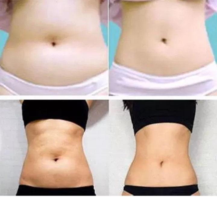Face & Body Fat Dissolving Injection Lipolysis The RED Solution 5x10ml(cc)